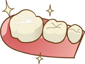 シーラント｜橋本駅の歯医者　翼歯科口腔クリニック