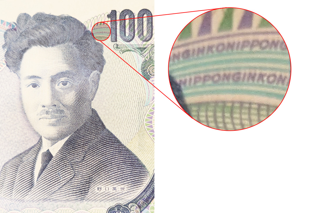 マイクロスコープによる視野拡大